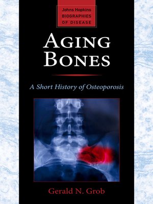 cover image of Aging Bones